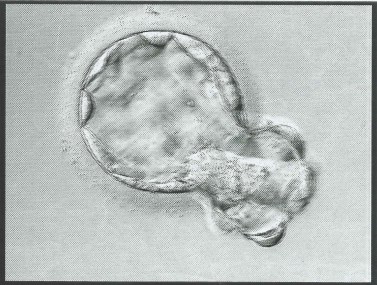 Our little boy when he was a six day old blastocyst just prior to implantation.